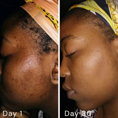 Klear® Cream - A313 Skin Revival Cream