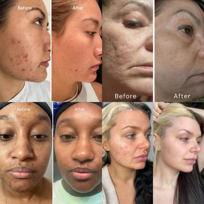 Klear® Cream - A313 Skin Revival Cream